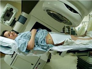 facts about radiation therapy