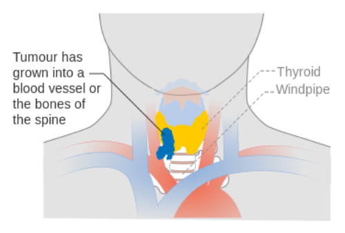 Facts about Thyroid Gland